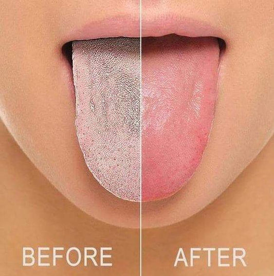 Flexible Oral Care Device