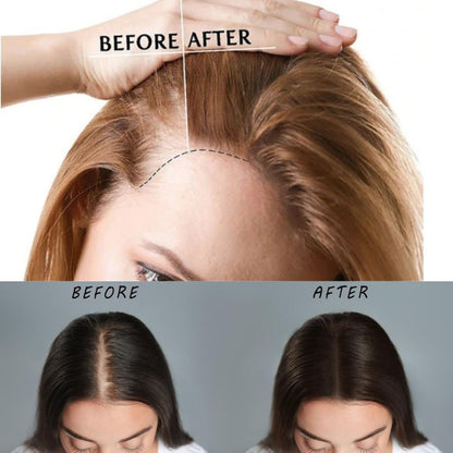 Portable Light Therapy Cap for Hair Growth