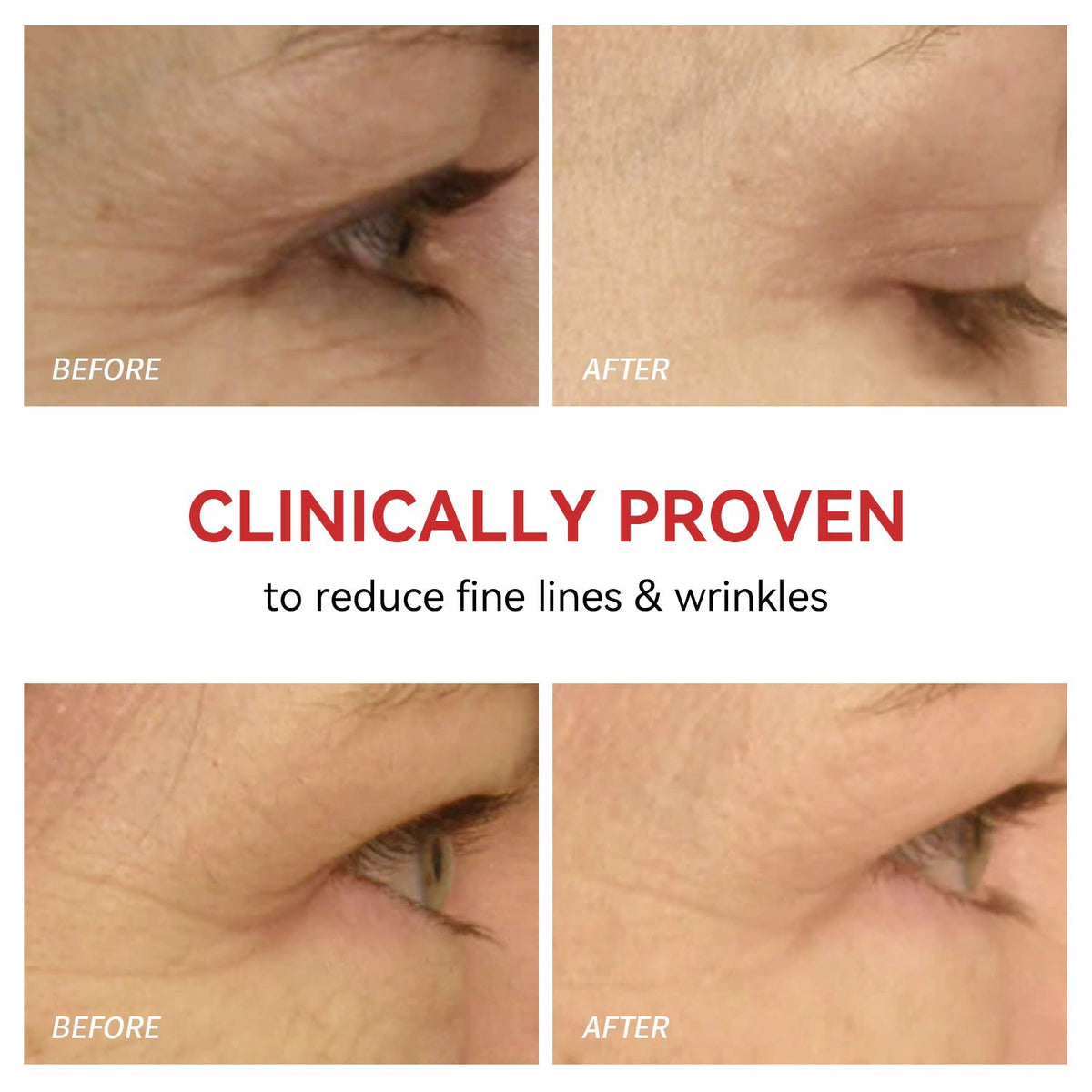 Illuminating Eye Therapy Device for Youthful Skin