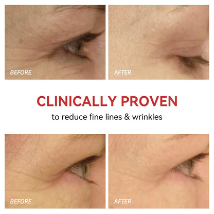 Illuminating Eye Therapy Device for Youthful Skin