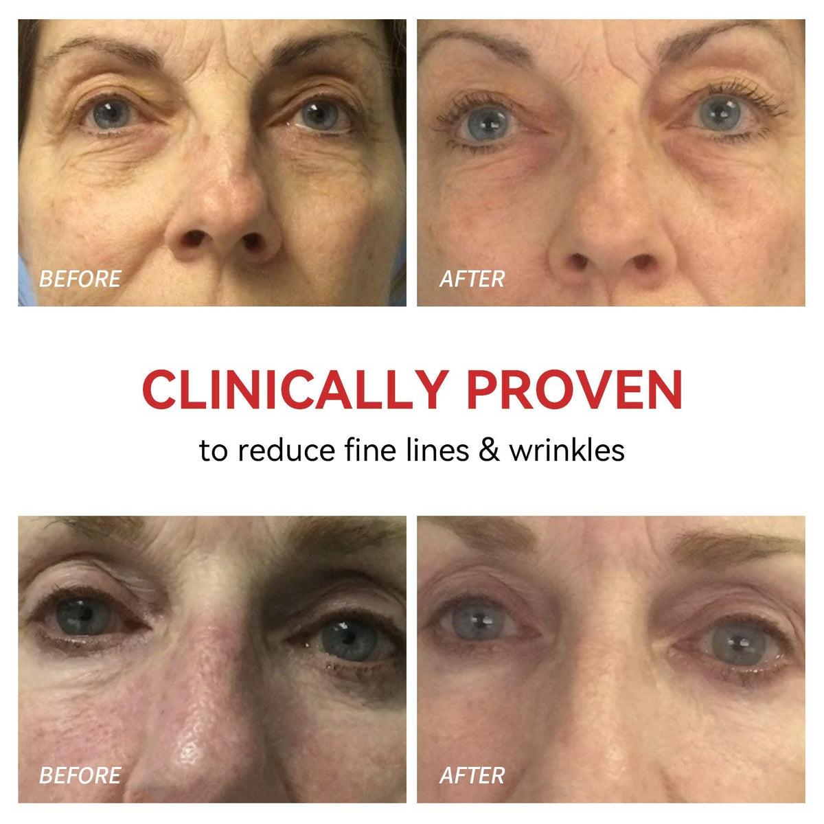 Illuminating Eye Therapy Device for Youthful Skin