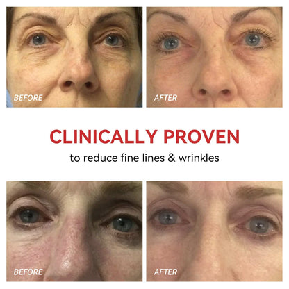 Illuminating Eye Therapy Device for Youthful Skin