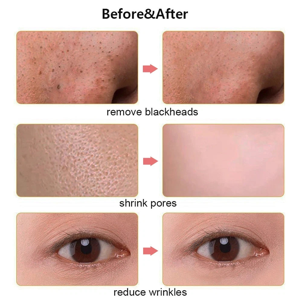 Ultrasonic Skin Scrubber for Deep Cleansing