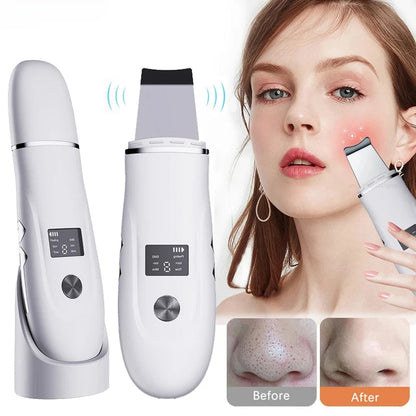 Ultrasonic Skin Scrubber for Deep Cleansing