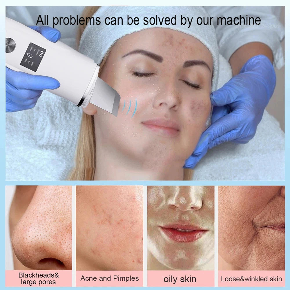 Ultrasonic Skin Scrubber for Deep Cleansing