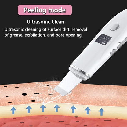 Ultrasonic Skin Scrubber for Deep Cleansing