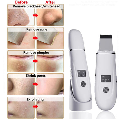Ultrasonic Skin Scrubber for Deep Cleansing