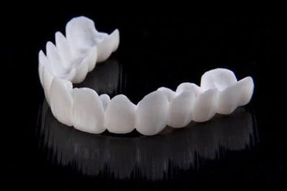 SmilePro – Effortless Dental Veneers for Lasting Confidence