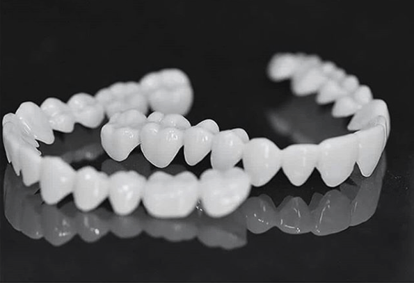 SmilePro – Effortless Dental Veneers for Lasting Confidence
