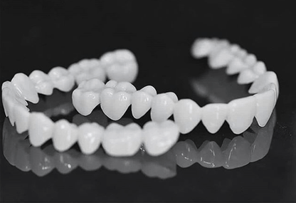SmilePro – Effortless Dental Veneers for Lasting Confidence