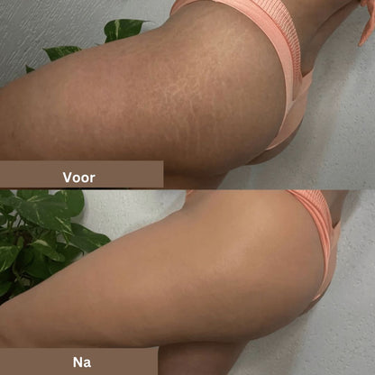 Skin Care Solution for Covering Scars, Veins, Acne, and Sunspots