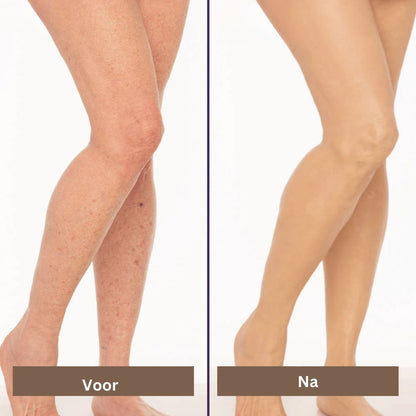Skin Care Solution for Covering Scars, Veins, Acne, and Sunspots
