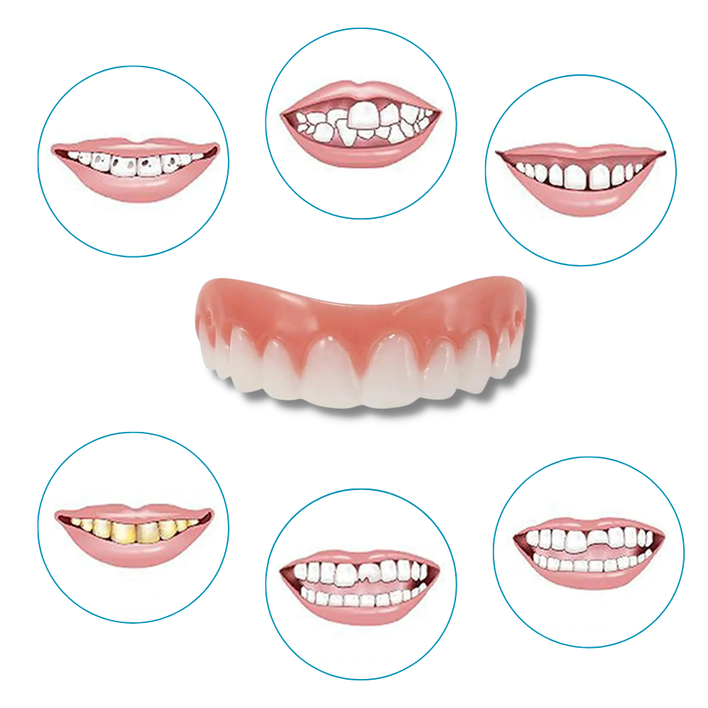 Snap-On Dental Veneers for Instant Smile Enhancement