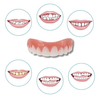 Snap-On Dental Veneers for Instant Smile Enhancement