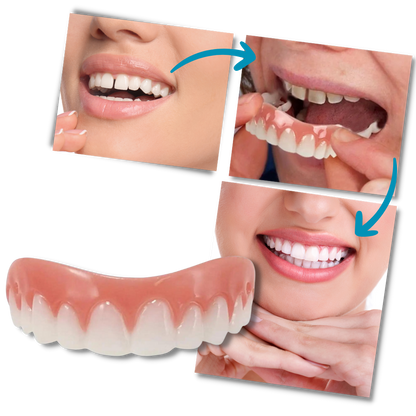 Snap-On Dental Veneers for Instant Smile Enhancement
