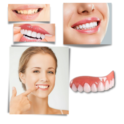 Snap-On Dental Veneers for Instant Smile Enhancement