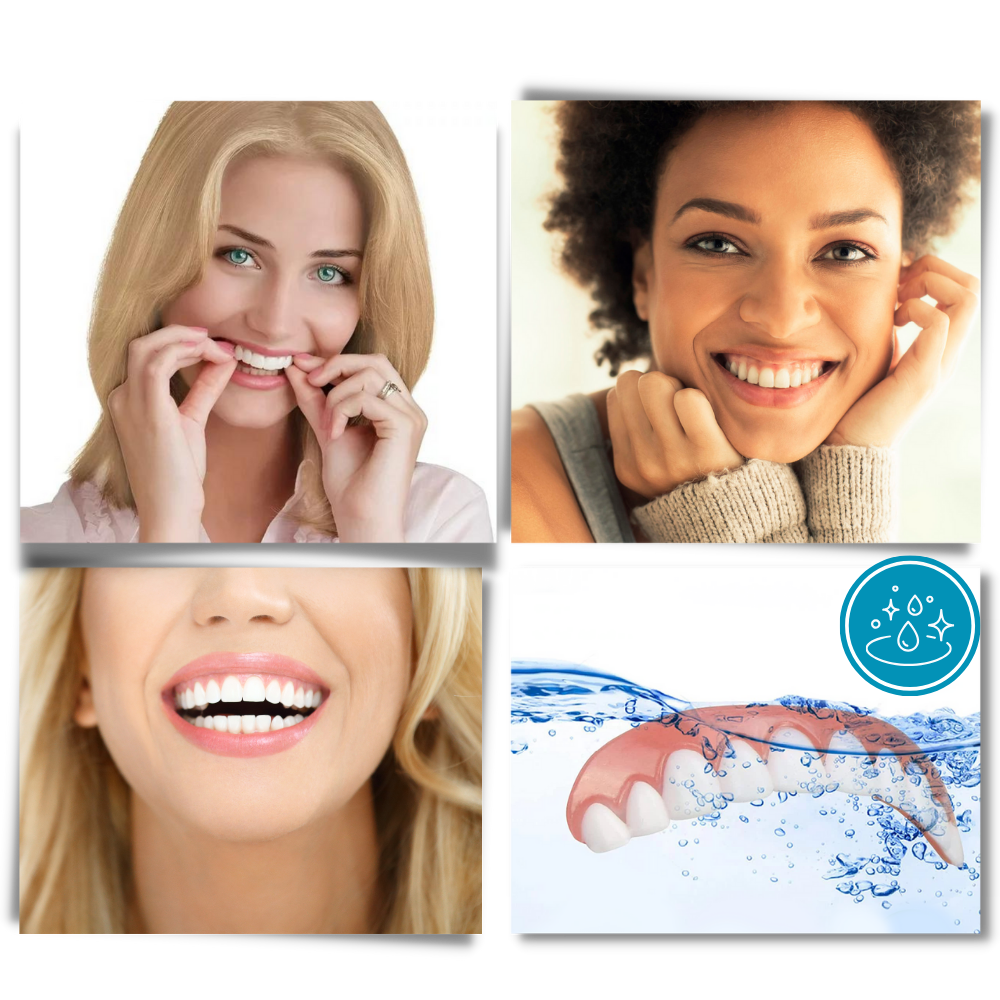 Snap-On Dental Veneers for Instant Smile Enhancement