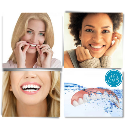 Snap-On Dental Veneers for Instant Smile Enhancement