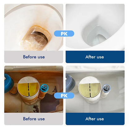 Toilet Bowl Cleaner for Effortless Hygiene